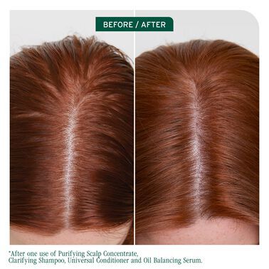 Scalp Sync Clarifying Shampoo - Biolage Renovation NZ | L'Oréal Partner Shop